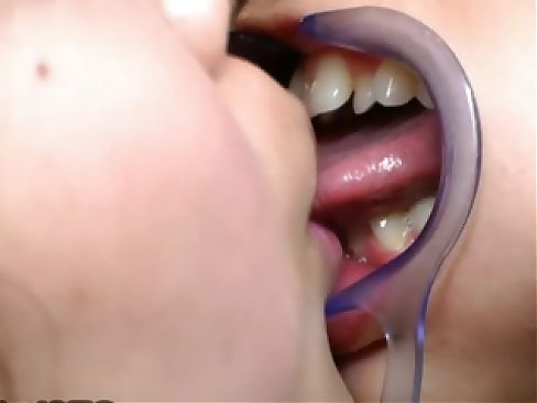 Two Japanese girls are doing some weird kissing with a mouth speculum
